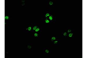Immunofluorescence staining of HepG2 cells with ABIN7153076 at 1:66, counter-stained with DAPI. (FOXN4 抗体  (AA 89-194))