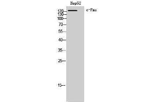 Western Blotting (WB) image for anti-Colony Stimulating Factor 1 Receptor (CSF1R) (Ser275) antibody (ABIN3183879)