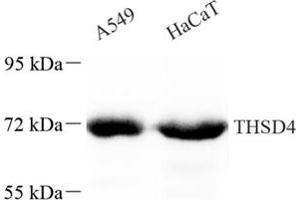 Western blot analysis of THSD4 (ABIN7075894),at dilution of 1: 200 (Thrombospondin, Type I, Domain Containing 4 (THSD4) 抗体)