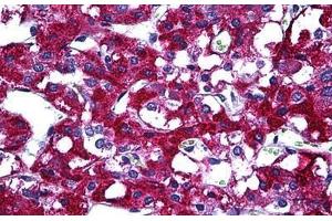 Human Adrenal: Formalin-Fixed, Paraffin-Embedded (FFPE) (PIM1 抗体  (AA 1-100))