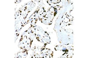 Immunohistochemistry of paraffin-embedded human placenta using RBM3 Rabbit mAb (ABIN7270084) at dilution of 1:25 (40x lens). (RBM3 抗体)