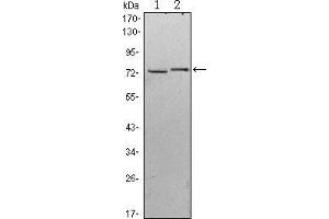 Western blot analysis using KLHL13 mouse mAb against Hela (1) and MCF-7 (2) cell lysate. (KLHL13 抗体)