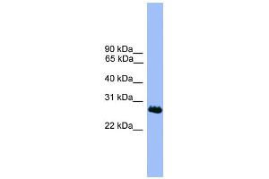 WB Suggested Anti-C1orf216 Antibody Titration: 0. (C1ORF216 抗体  (N-Term))