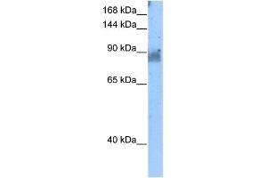 NELL2 antibody used at 5 ug/ml to detect target protein. (NELL2 抗体)