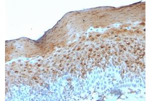 Formalin-fixed, paraffin-embedded human Tonsil stained with Involucrin Mouse Monoclonal Antibody (SY5). (Involucrin 抗体)