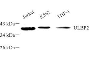 Western blot analysis of ULBP256 (ABIN7076145) at dilution of 1: 500 (ULBP2 抗体)