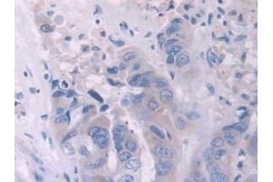Immunohistochemistry (IHC) image for anti-Interleukin 2 (IL2) (AA 21-153) antibody (ABIN7430795)