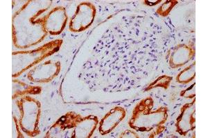 IHC image of  diluted at 1:100 and staining in paraffin-embedded human kidney tissue performed on a Leica BondTM system. (Recombinant GSK3 beta 抗体  (pSer9))