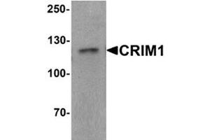 Western blot analysis of CRIM1 in Jurkat cell lysate with CRIM1 Antibody  at 1 ug/ml. (CRIM1 抗体  (C-Term))