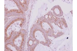 Immunohistochemistry (IHC) image for anti-Golgi Brefeldin A Resistant Guanine Nucleotide Exchange Factor 1 (GBF1) (N-Term) antibody (ABIN2855449)