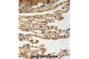 Immunohistochemistry (IHC) image for anti-FK506 Binding Protein Like (FKBPL) antibody (ABIN3002248) (FKBPL 抗体)