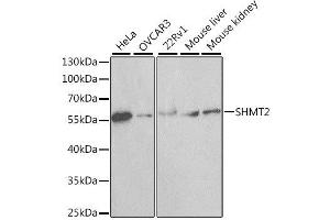 Western blot analysis of extracts of various cell lines, using SHMT2 antibody. (SHMT2 抗体  (AA 265-504))