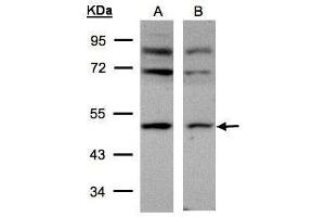 WB Image Sample(30 μg of whole cell lysate) A:293T B:HeLa S3, 10% SDS PAGE antibody diluted at 1:500 (AP2M1 抗体  (Center))