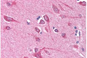 Human Brain, Cortex (formalin-fixed, paraffin-embedded) stained with BCL10 antibody ABIN214584 at 5 ug/ml followed by biotinylated goat anti-rabbit IgG secondary antibody ABIN481713, alkaline phosphatase-streptavidin and chromogen. (BCL10 抗体  (N-Term))