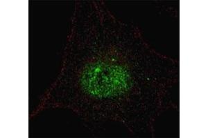 Fluorescent confocal image of SY5Y cells stained with phospho-PDX1 antibody. (PDX1 抗体  (pThr11))