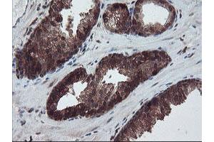 Image no. 1 for anti-RAB, Member of RAS Oncogene Family-Like 2A (RABL2A) antibody (ABIN1500575) (RABL2A 抗体)