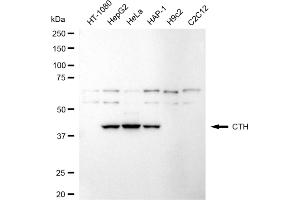 Western blotting analysis using CTH antibody (ABIN7798233). (Recombinant CTH 抗体)