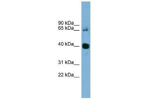 NODAL antibody used at 1 ug/ml to detect target protein. (Nodal 抗体)
