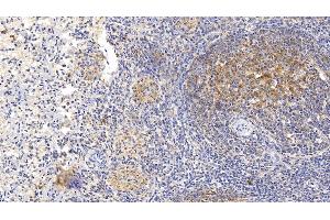 Immunohistochemistry (IHC) image for anti-Sema Domain, Seven Thrombospondin Repeats (Type 1 and Type 1-Like), Transmembrane Domain (TM) and Short Cytoplasmic Domain, (Semaphorin) 5B (SEMA5B) (AA 350-602) antibody (ABIN7426943)