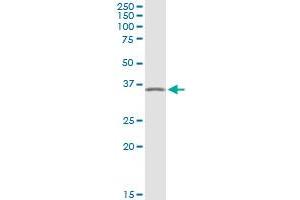 Western Blotting (WB) image for anti-Protein Kinase, AMP-Activated, gamma 1 Non-Catalytic Subunit (PRKAG1) (AA 1-247) antibody (ABIN948313)