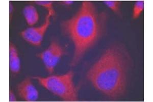 Image no. 3 for anti-Adducin 1 (Alpha) (ADD1) (pSer726) antibody (ABIN196918) (alpha Adducin 抗体  (pSer726))