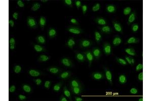 Immunofluorescence of monoclonal antibody to BCL9 on HeLa cell. (BCL9 抗体  (AA 1036-1135))
