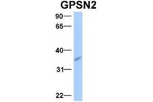 Host:  Rabbit  Target Name:  GPSN2  Sample Type:  Human Fetal Brain  Antibody Dilution:  1. (TECR 抗体  (Middle Region))