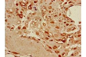 Immunohistochemistry of paraffin-embedded human placenta tissue using ABIN7149878 at dilution of 1:100 (DKK1 抗体  (AA 33-266))