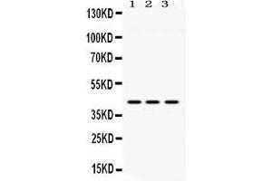 Western blot analysis of ACAA2 expression in rat lung extract ( Lane 1), mouse brain extract ( Lane 2) and HELA whole cell lysates ( Lane 3). (ACAA2 抗体  (Middle Region))
