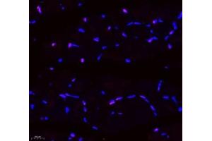 Immunofluorescence of paraffin embedded mouse skeletal muscle using SIX1 (ABIN7075617) at dilution of 1: 650 (400x lens) (SIX Homeobox 1 抗体)