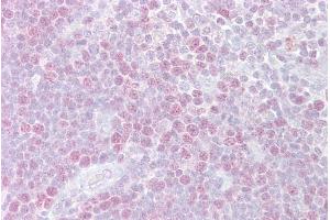 Immunohistochemistry (IHC) image for anti-Minichromosome Maintenance Complex Component 3 (MCM3) (C-Term) antibody (ABIN2774880)