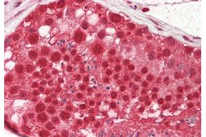 Immunohistochemistry (IHC) image for anti-Cleavage Stimulation Factor, 3' Pre-RNA, Subunit 2, 64kDa (CSTF2) (N-Term) antibody (ABIN2778765)