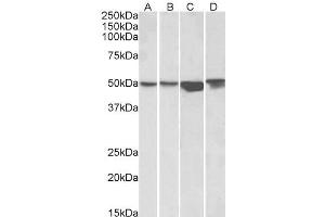 ABIN570904 (1µg/ml) staining of HEK293 (A), A431 (B), HeLa (C) and Jurkat (D) lysates (35µg protein in RIPA buffer). (ILK 抗体  (C-Term))