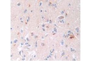 IHC-P analysis of Human Brain Tissue, with DAB staining. (BNP 抗体)