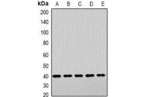 Western blot analysis of LHX6 expression in HepG2 (A), NIH3T3 (B), mouse brain (C), mouse liver (D), rat heart (E) whole cell lysates. (LHX6 抗体)