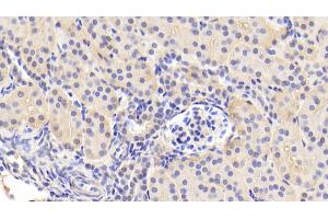 Detection of ANGPT1 in Human Kidney Tissue using Polyclonal Antibody to Angiopoietin 1 (ANGPT1) (Angiopoietin 1 抗体  (AA 284-452))