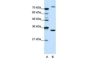 Western Blotting (WB) image for anti-Exosome Component 2 (EXOSC2) antibody (ABIN2462254) (EXOSC2 抗体)