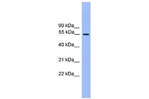 WB Suggested Anti-UBQLN2 Antibody Titration: 0. (Ubiquilin 2 抗体  (N-Term))
