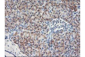 Immunohistochemical staining of paraffin-embedded Human pancreas tissue using anti-MTFMT mouse monoclonal antibody. (MTFMT 抗体  (AA 175-389))