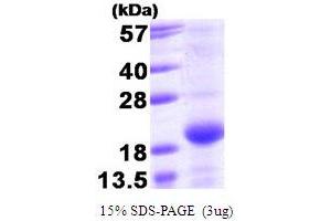 SDS-PAGE (SDS) image for Bcl2 Modifying Factor (BMF) (AA 1-129) protein (T7 tag) (ABIN666770) (BMF Protein (AA 1-129) (T7 tag))