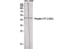 Western Blot (WB) analysis of specific cells using Phospho-ATF-2 (S62) Polyclonal Antibody.