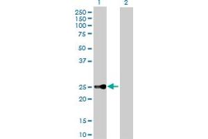 Western Blot analysis of CBX5 expression in transfected 293T cell line by CBX5 MaxPab polyclonal antibody. (CBX5 抗体  (AA 1-191))