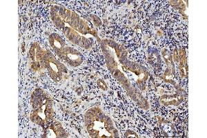 IHC analysis of RPL10 using anti-RPL10 antibody (ABIN7601177). (RPL10 抗体  (AA 3-214))