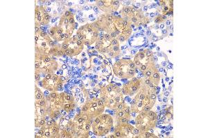 Immunohistochemistry of paraffin-embedded rat kidney using HPD antibody (ABIN5973894) at dilution of 1/100 (40x lens). (HPD 抗体)