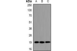 Western blot analysis of UBE2G1 expression in HeLa (A), NIH3T3 (B), H9C2 (C) whole cell lysates. (UBE2G1 抗体)