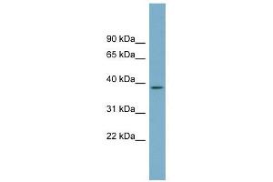 SDSL antibody used at 1 ug/ml to detect target protein. (SDSL 抗体  (N-Term))
