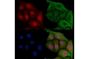 ABIN6257316 and ABIN6275218 staining Hela cells by IF/ICC. (MAD2L1BP 抗体  (N-Term))