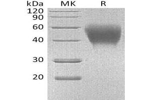 Signaling Lymphocytic Activation Molecule Family Member 1 (SLAMF1) protein (His tag)