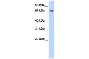 WB Suggested Anti-DLG3 Antibody Titration:  0. (DLG3 抗体  (N-Term))