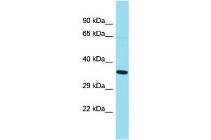 Western Blotting (WB) image for anti-G Kinase Anchoring Protein 1 (GKAP1) (N-Term) antibody (ABIN2791554) (GKAP1 抗体  (N-Term))